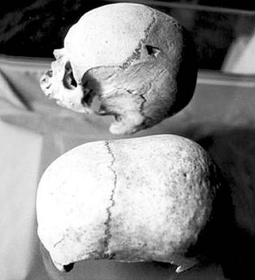 Необычные черепа на Мальте